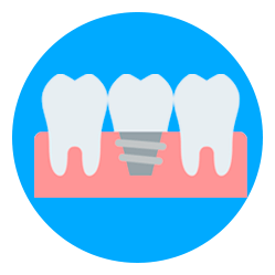 Implantes dentales