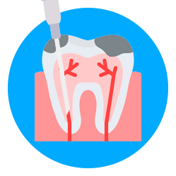 Endodoncia